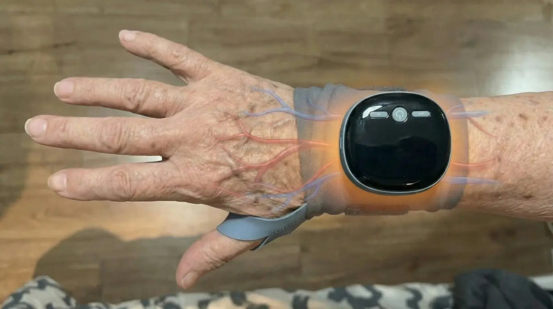 Handgelenkbandage bei Karpaltunnelsyndrom: Hilft sie wirklich?