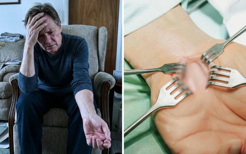 Links: Mann mit chronischen Karpaltunnel-Schmerzen hält schmerzend sein Handgelenk – zeigt Leidensdruck vor Behandlung. Rechts: Chirurgische Instrumente (Klemmen) bei Karpaltunnel-Operation – visualisiert minimalinvasiven Eingriff und Dekompression.