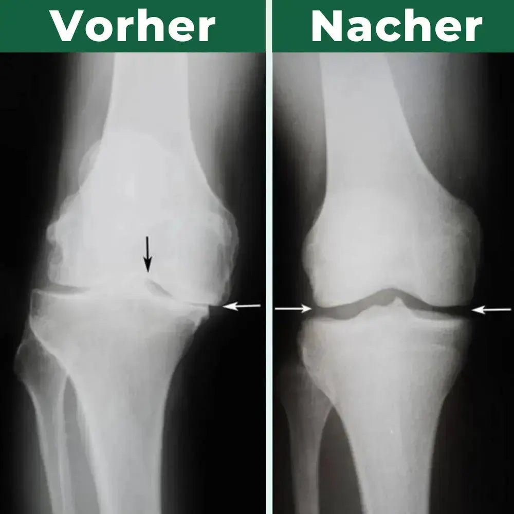 Asipu™ Knie-Massagegerät - Asipu.Deutschland