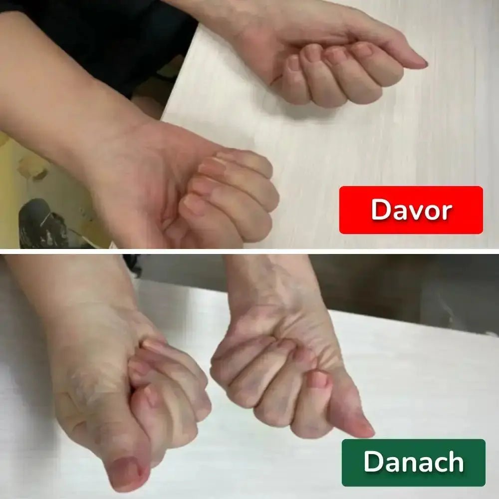Nervio 3 - in - 1 Handgelenksstütze - Asipu.Deutschland