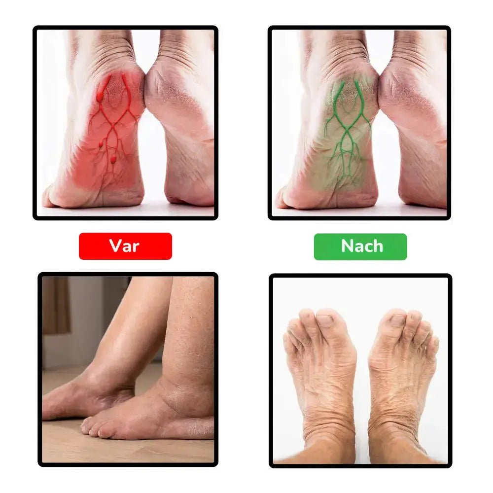 SmartSocks - Spürbare Erleichterung bei Fußneuropathie - Asipu.Deutschland